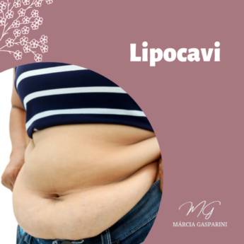 Comprar o produto de Lipocavi em Bauru em Estética Corporal em Bauru, SP por Solutudo