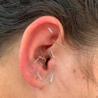 Comprar o produto de Auriculoterapia -  Acupuntura auricular  em Acupuntura em Botucatu, SP por Solutudo