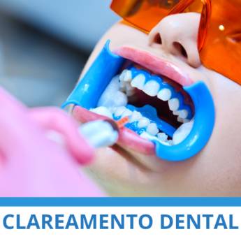 Comprar o produto de Clareamento Dental em Odontologia em Itapetininga, SP por Solutudo