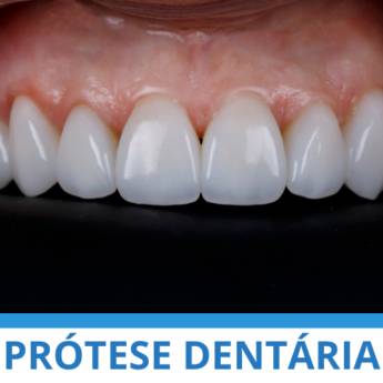 Comprar o produto de Prótese Dentária em Odontologia em Itapetininga, SP por Solutudo