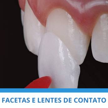 Comprar produto Facetas e Lentes de Contato em Odontologia pela empresa Clínica Mário Munhoz em Itapetininga, SP