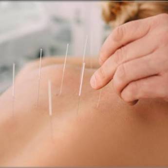 Comprar o produto de Acupuntura Sistêmica e Auriculoterapia em Acupuntura em Itupeva, SP por Solutudo