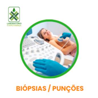 Comprar o produto de Biopsias/ Punções em Exames  em Itapetininga, SP por Solutudo