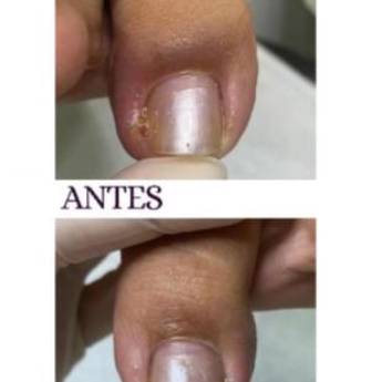 Comprar o produto de Clínica de podolodia em Itatinga em Podologia em Itaitinga, CE por Solutudo