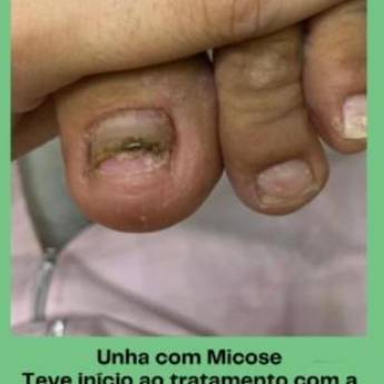 Comprar o produto de Profissional em podologia em Podologia em Itaitinga, CE por Solutudo