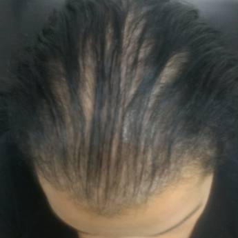 Comprar o produto de Tratamento Capilar em Clínicas de Estética e Esteticistas em Belo Horizonte, MG por Solutudo