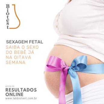 Comprar produto Sexagem Fetal em Laboratórios Clínicos pela empresa Biotest em Botucatu, SP