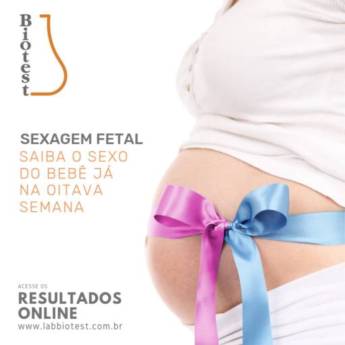 Comprar produto Sexagem Fetal em Laboratórios Clínicos pela empresa Biotest Unidade Cohab 1 - Posto de Coleta  em Botucatu, SP