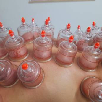 Comprar o produto de Ventosaterapia em Ventosaterapia em Jundiaí, SP por Solutudo