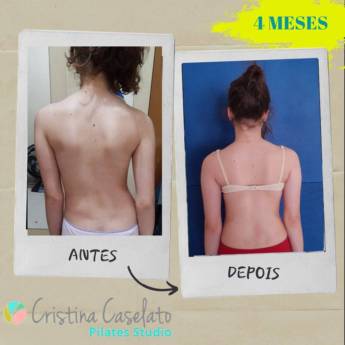 Comprar o produto de Aula de Correção Postural em Bauru em Pilates em Bauru, SP por Solutudo