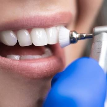 Comprar o produto de (Profilaxia) Limpeza em Odontologia em Resende, RJ por Solutudo