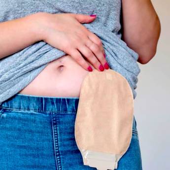 Comprar o produto de Bolsas para Estomias em Produtos Hospitalares em São Caetano do Sul, SP por Solutudo