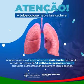 Comprar o produto de A campanha de combate à Tuberculose continua em Leopoldina! em Saúde em Leopoldina, MG por Solutudo
