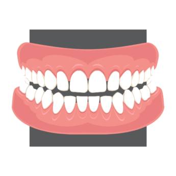 Comprar o produto de Lente de contato dentária em Odontologia em Botucatu, SP por Solutudo