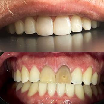 Comprar o produto de Tratamento Odontológico em Odontologia em Botucatu, SP por Solutudo