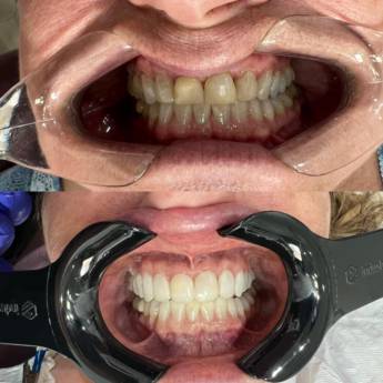 Comprar o produto de Odontologia Estética em Odontologia em Botucatu, SP por Solutudo