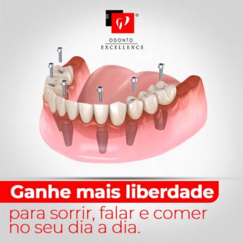 Comprar o produto de Prótese Dentária em Odontologia pela empresa Odonto Excellence - Elaine R. da Silva CRO:110.721 CRO/SP:14.557 em Botucatu, SP por Solutudo