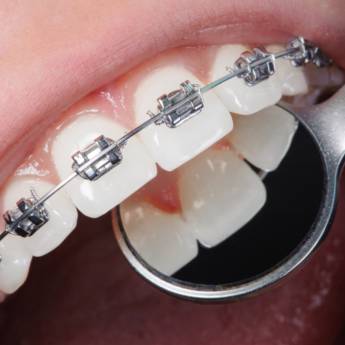 Comprar o produto de Ortodontia em Odontologia em Botucatu, SP por Solutudo