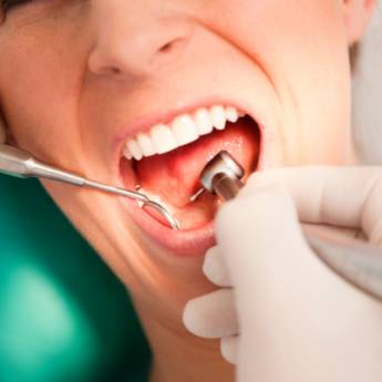 Comprar o produto de Limpeza Dentária  em Odontologia em Botucatu, SP por Solutudo