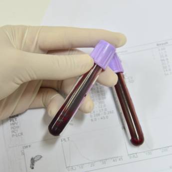 Comprar o produto de Exame de sangue veterinário de perfil renal: ureia e creatinina em Bauru em Exames em Bauru, SP por Solutudo