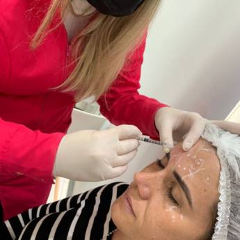 Comprar o produto de Toxina botulínica (botox) em Bauru em Estética Facial em Bauru, SP por Solutudo