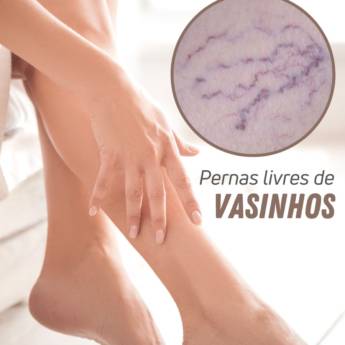 Comprar o produto de Tratamento de varizes em Serviços de Estética em Rio Verde, GO por Solutudo Comprar o produto de Tratamento de varizes em Serviços de Estética em Rio Verde, GO por Solutudo