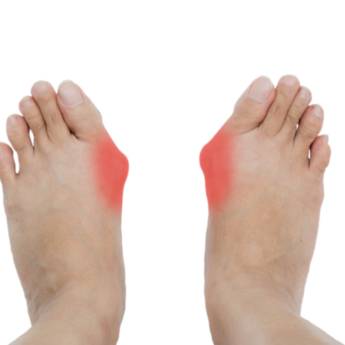 Comprar o produto de Dores nos Pés e Joanetes em Podologia em São Paulo, SP por Solutudo