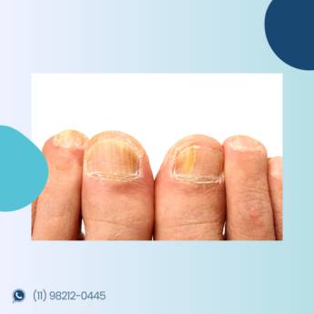 Comprar o produto de QUIROPODOLOGIA em Podiatria em Jundiaí, SP por Solutudo