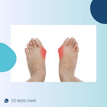 Comprar o produto de ORTOPOLOGIA/BIOMECÂNICA em Podiatria em Jundiaí, SP por Solutudo