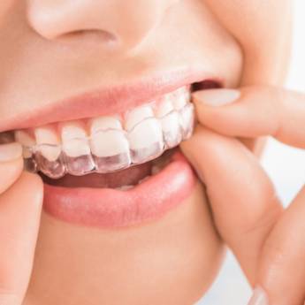 Comprar o produto de Invisalign  em Odontologia em Vinhedo, SP por Solutudo