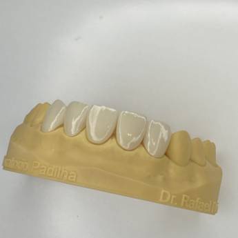 Comprar o produto de Faceta de resina e cerâmica (lente de contato) em Odontologia em Vitória, ES por Solutudo