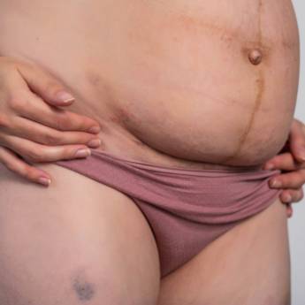 Comprar o produto de Bandagens Pós Parto para Abdômen em Nossos Serviços em Americana, SP por Solutudo