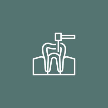 Comprar produto Tratamento de Canal em Bauru em Odontologia pela empresa DentiSão Clínica Odontológica em Bauru, SP