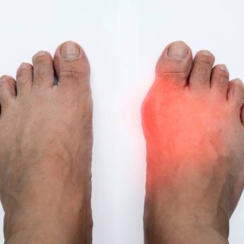 Comprar o produto de Tratamento Natural para Acido Úrico em Bauru em Terapia Alternativa em Bauru, SP por Solutudo