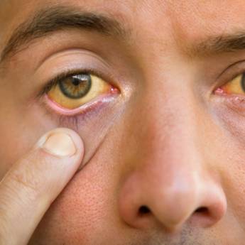 Comprar o produto de Tratamento natural para Hepatite em Bauru em Terapia Alternativa em Bauru, SP por Solutudo