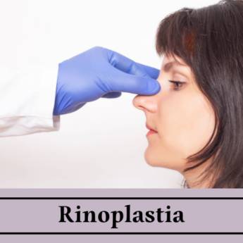 Comprar o produto de Rinoplastia em Cirurgias em Itapetininga, SP por Solutudo