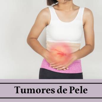 Comprar produto Tumores de Pele em Cirurgias pela empresa Dr. Jose Roberto Tambelli Pires em Itapetininga, SP