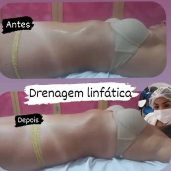 Comprar o produto de  Drenagem Linfática - Revitalize seu Corpo no Rio de Janeiro/RJ em Clínicas de Estética e Esteticistas pela empresa Encanto Estética em Rio de Janeiro, RJ por Solutudo