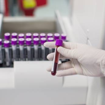 Comprar o produto de Hemograma Completo - Monitorando a Saúde Sanguínea com Precisão e Cuidado em Clínica Médica em São João de Meriti, RJ por Solutudo