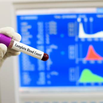 Comprar o produto de Contagem de Plaquetas - Monitorando a Saúde Sanguínea com Precisão e Prevenção em Clínica Médica em São João de Meriti, RJ por Solutudo