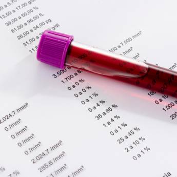 Comprar o produto de Hemograma completo em Bauru em Exames  em Bauru, SP por Solutudo