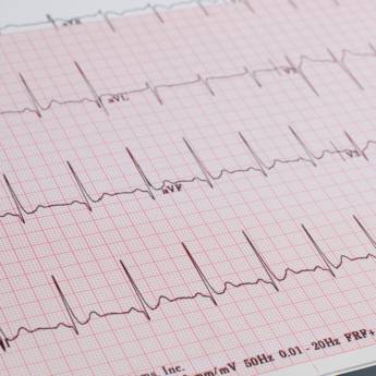 Comprar o produto de Exame ECG (Eletrocardiograma) em Bauru em Exames  em Bauru, SP por Solutudo