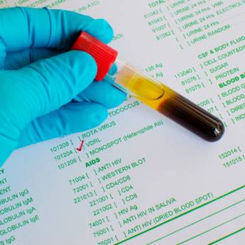 Comprar o produto de Exame VDRL em Bauru em Exames  em Bauru, SP por Solutudo