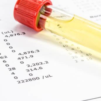 Comprar o produto de Exame Toxicológico em Bauru em Exames  em Bauru, SP por Solutudo