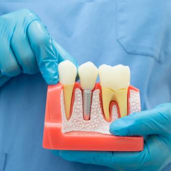 Comprar o produto de Tratamento de Canal com Microscopia em Niterói: Precisão e Conforto Garantidos em Odontologia em Niterói, RJ por Solutudo