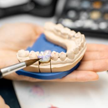 Comprar o produto de Restaurações Dentárias em Niterói: Recupere a Funcionalidade e Estética dos seus Dentes em Odontologia em Niterói, RJ por Solutudo