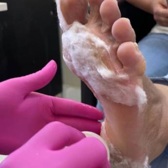 Comprar o produto de Plástica dos Pés  em SPA dos Pés em Mineiros, GO por Solutudo