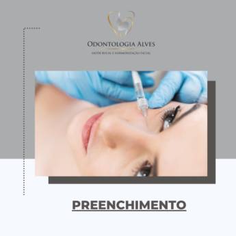 Comprar o produto de Preenchimento com ácido hialurônico em Itapetininga em Estética Orofacial em Itapetininga, SP por Solutudo