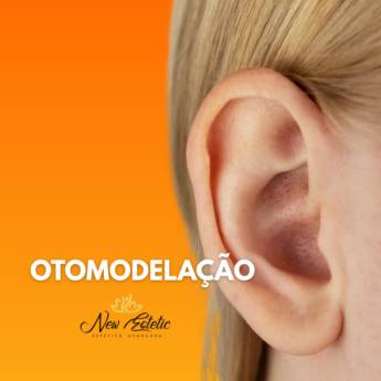Comprar o produto de Otomodelação - Correção Orelhas de Abano em Foz do Iguaçu   em Estética Facial em Foz do Iguaçu, PR por Solutudo Comprar o produto de Otomodelação - Correção Orelhas de Abano em Foz do Iguaçu   em Estética Facial em Foz do Iguaçu, PR por Solutudo