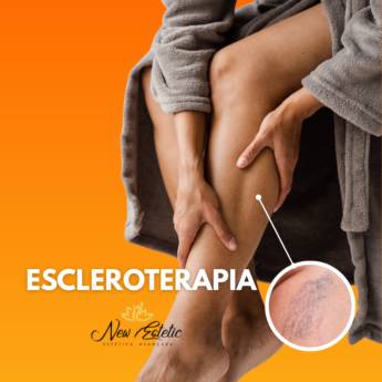 Comprar o produto de Escleroterapia em Foz do Iguaçu em Estética Corporal em Foz do Iguaçu, PR por Solutudo Comprar o produto de Escleroterapia em Foz do Iguaçu em Estética Corporal em Foz do Iguaçu, PR por Solutudo